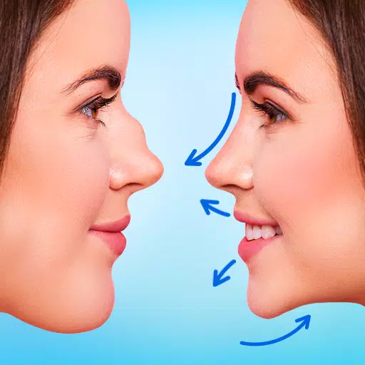 Rhinoplasty