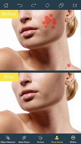 Photo Retouch-Object Removal 스크린샷 1