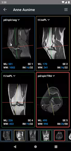 IDV - IMAIOS DICOM Viewer Скриншот 2