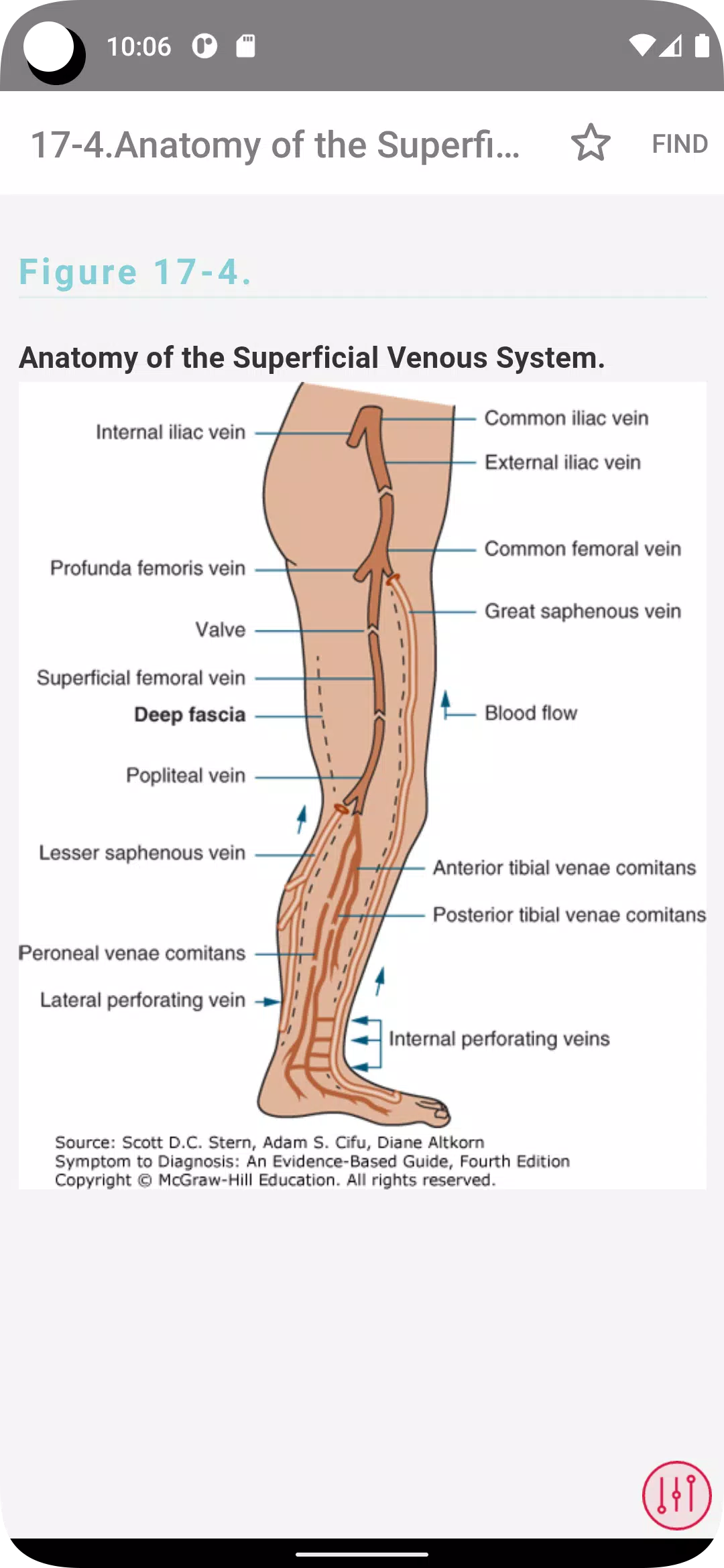 Schermata Symptom to Diagnosis 1